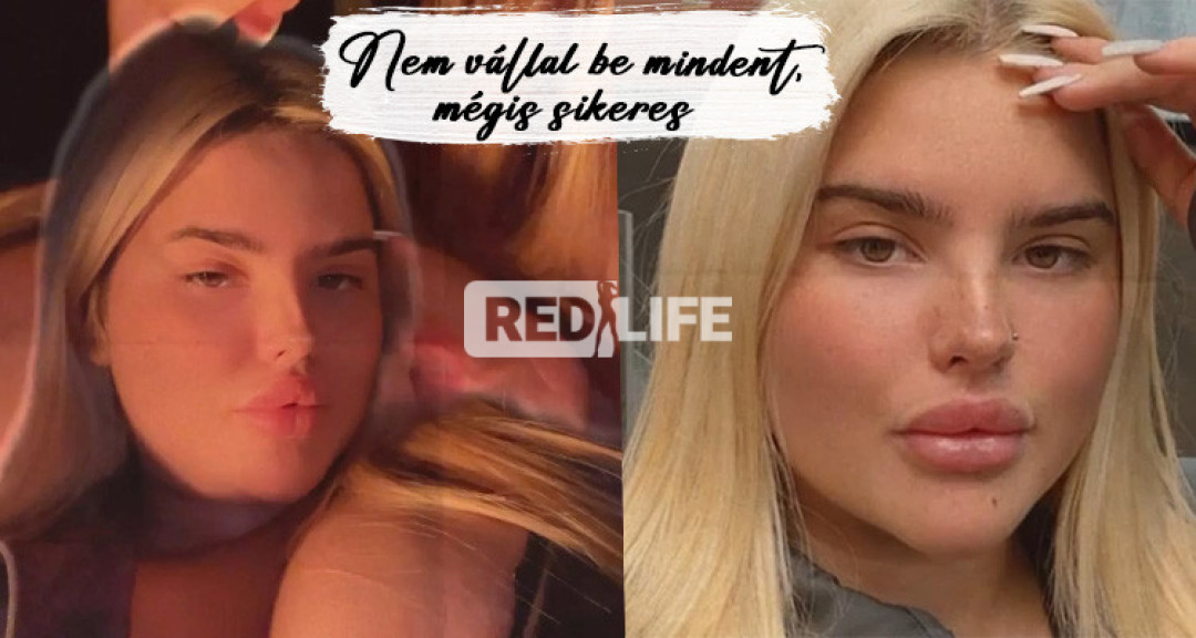 Nem kell mindent bevállalni OnlyFans